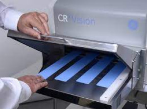 Scanner cr - radiographie numérique - Devis sur Techni-Contact.com - 1